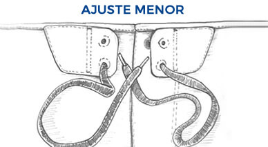 Ajuste Menor 5